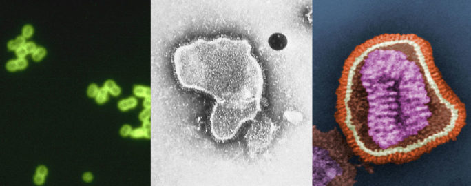 Bakterier och virus som orsakar lunginflammation